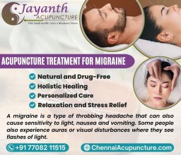 Acupuncture treatment For Migraine and Headaches in Chennai