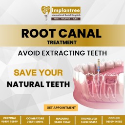 Advanced Root Canal Treatment in Chennai