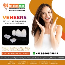 Smile Makeover in Chennai